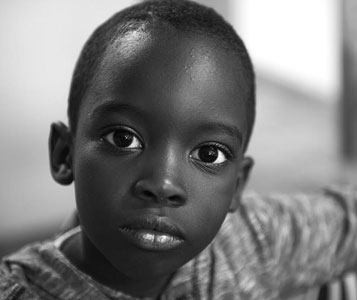 ONG Tierra de Hombres ayuda a niños con patologías graves en países subdesarrollados