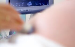 La cuarentena y el estrés producido durante la pandemia, algunas causas de desequilibrio hormonal