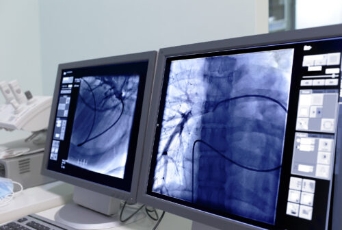 Radiología Cardiovascular e Intervencionista