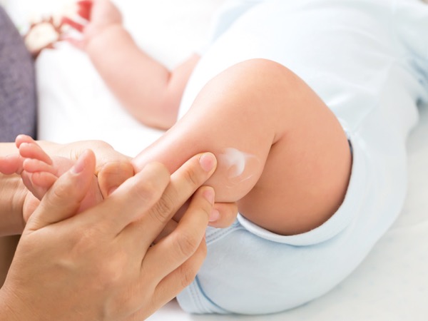 Dermatitis atópica: un prurito continuado puede provocar cambios conductuales en el niño y su entorno social