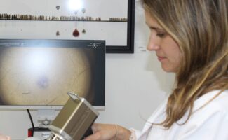 Una vez al año es necesario revisar tus lunares mediante dermatoscopia digital