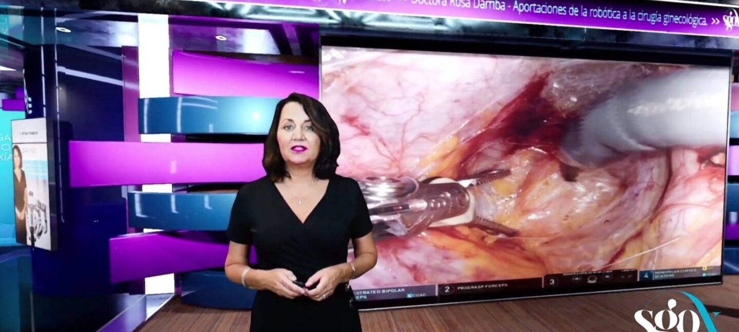 Endometriosis, suelo pélvico y miomas, nuevas aplicaciones ginecológicas de la cirugía robótica