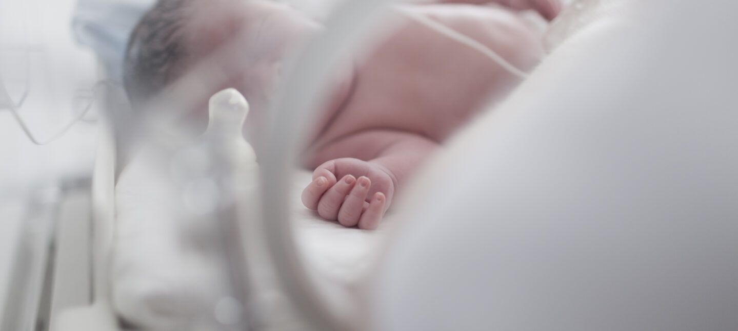El pie zambo y la displasia del desarrollo de la cadera, casos más frecuentes en traumatología infantil del recién nacido