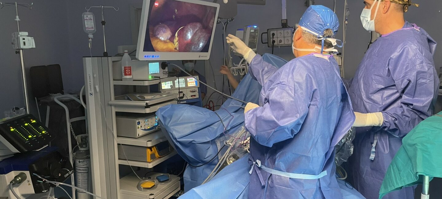 El Hospital Vithas Almería marca un hito en la cirugía hepática con una operación pionera en la provincia