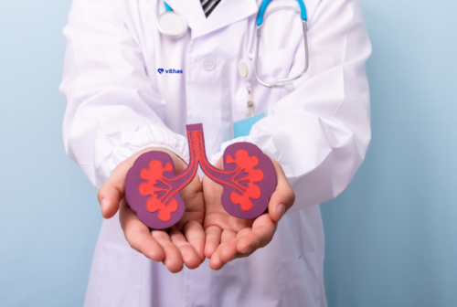 Cálculos en el riñón - Litiasis Renal