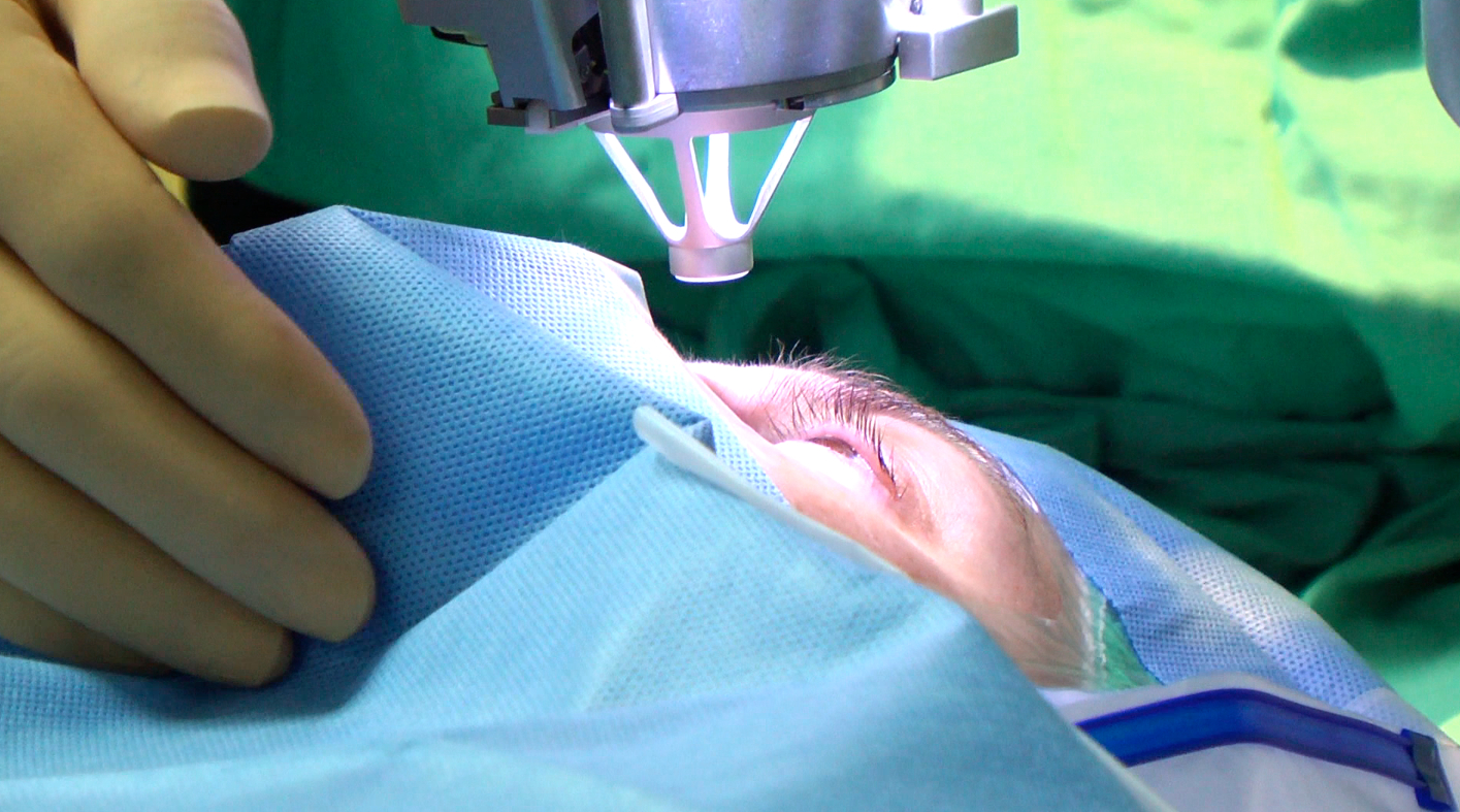 Nuevas técnicas quirúrgicas retrasan el deterioro del nervio óptico, principal causa de la ceguera por glaucoma