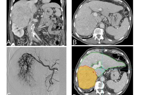 Radiología Intervencionista