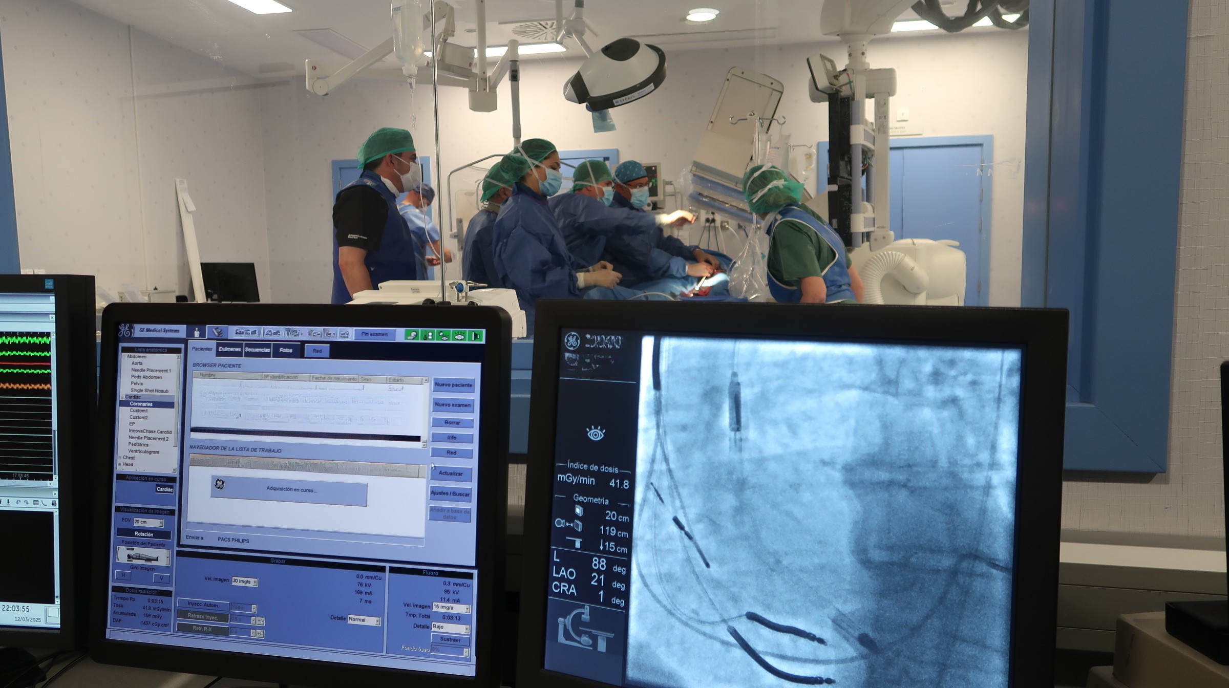 Vithas Sevilla realiza una intervención cardiaca pionera en la sanidad privada