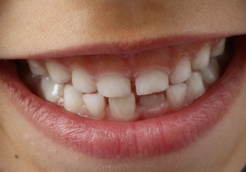 Odontología infantil Odontología infantil