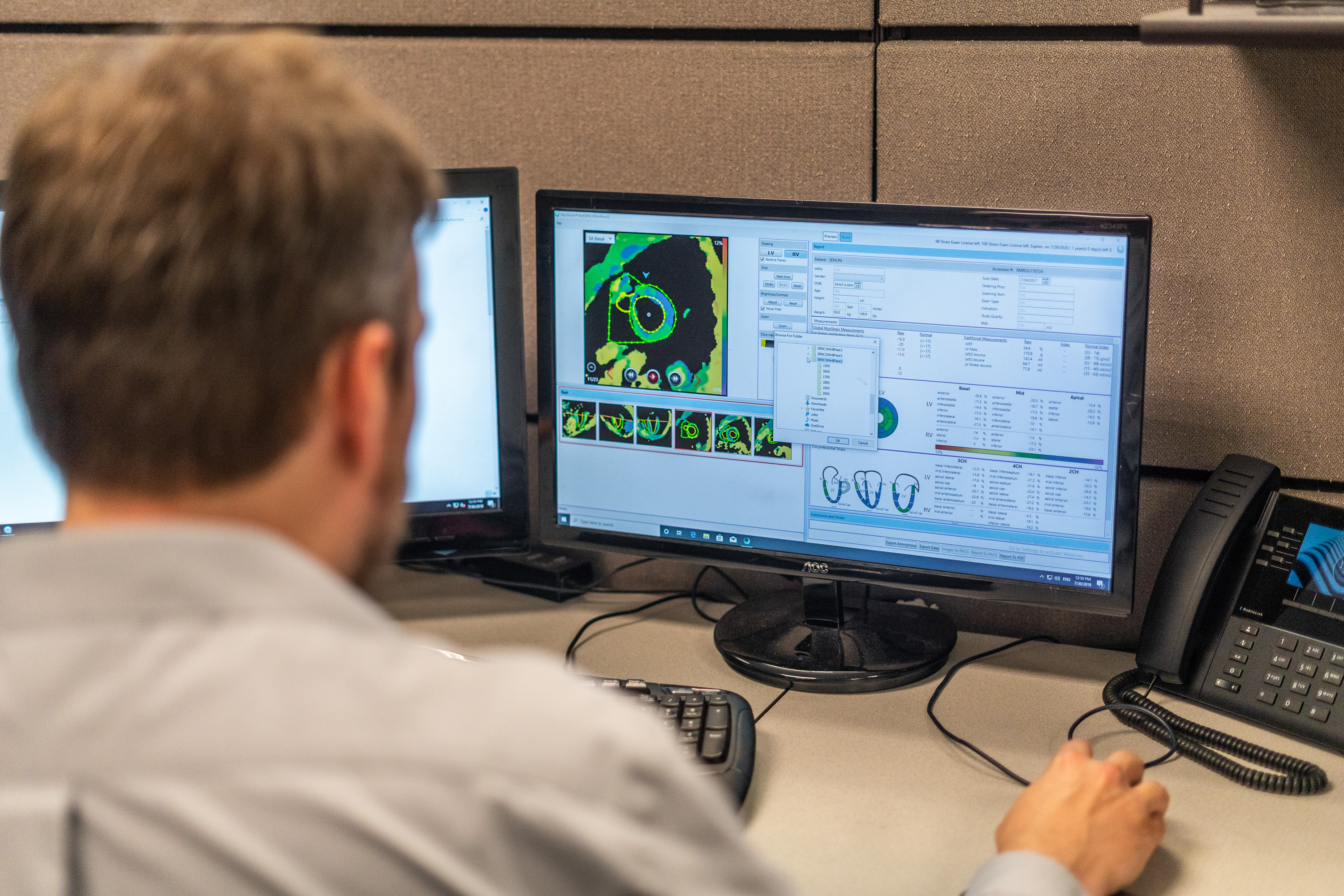 Vithas Vigo, primer hospital gallego en ofertar una resonancia magnética MyoStrain, para el diagnóstico precoz de disfunciones cardiacas