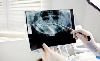 Cáncer oral: la importancia de la auto exploración