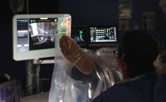 El Hospital Universitario Vithas Madrid La Milagrosa incorpora la cirugía robótica de próstata para preservar la función sexual