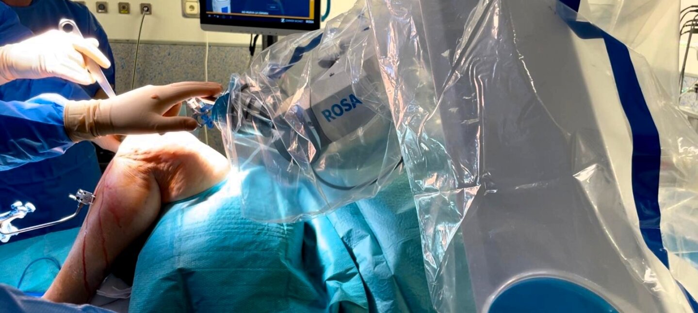 Vithas Valencia 9 de Octubre incorpora la última tecnología en inteligencia artificial y robótica para implantes de rodilla Vithas Valencia 9 de Octubre incorpora la última tecnología en inteligencia artificial y robótica para implantes de rodilla