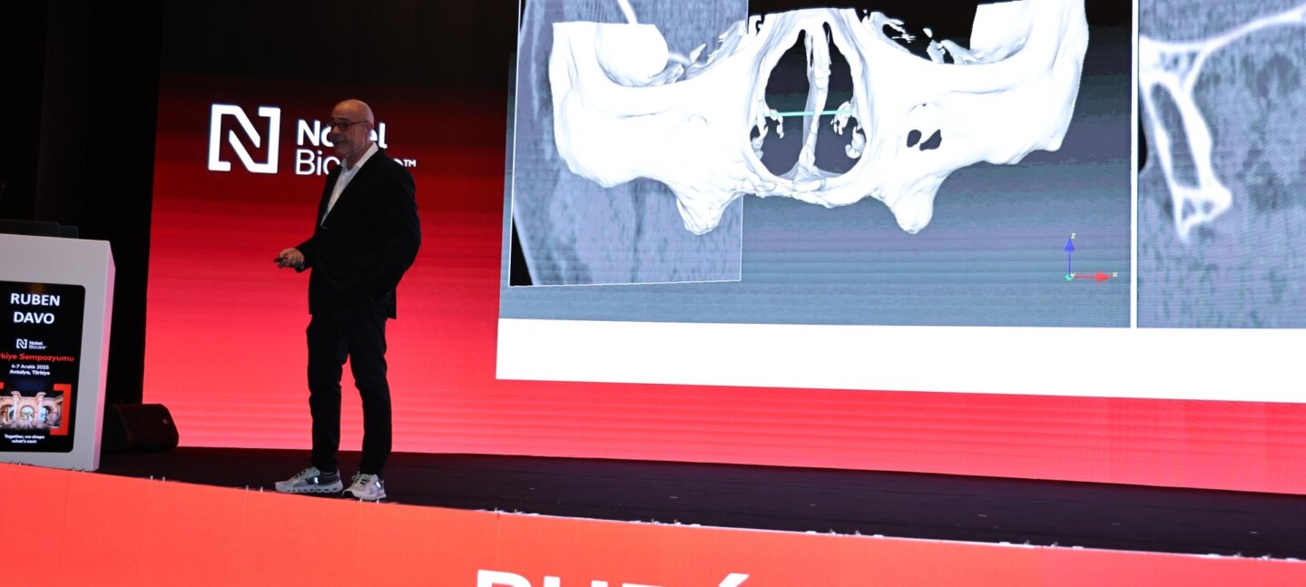 Un estudio internacional coliderado por el Dr. Rubén Davó, de Vithas Medimar, valida el uso de la IA en la planificación de cirugía de implantes cigomáticos Un estudio internacional coliderado por el Dr. Rubén Davó, de Vithas Medimar, valida el uso de la IA en la planificación de cirugía de implantes cigomáticos