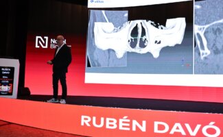 Un estudio internacional coliderado por el Dr. Rubén Davó, de Vithas Medimar, valida el uso de la IA en la planificación de cirugía de implantes cigomáticos Un estudio internacional coliderado por el Dr. Rubén Davó, de Vithas Medimar, valida el uso de la IA en la planificación de cirugía de implantes cigomáticos