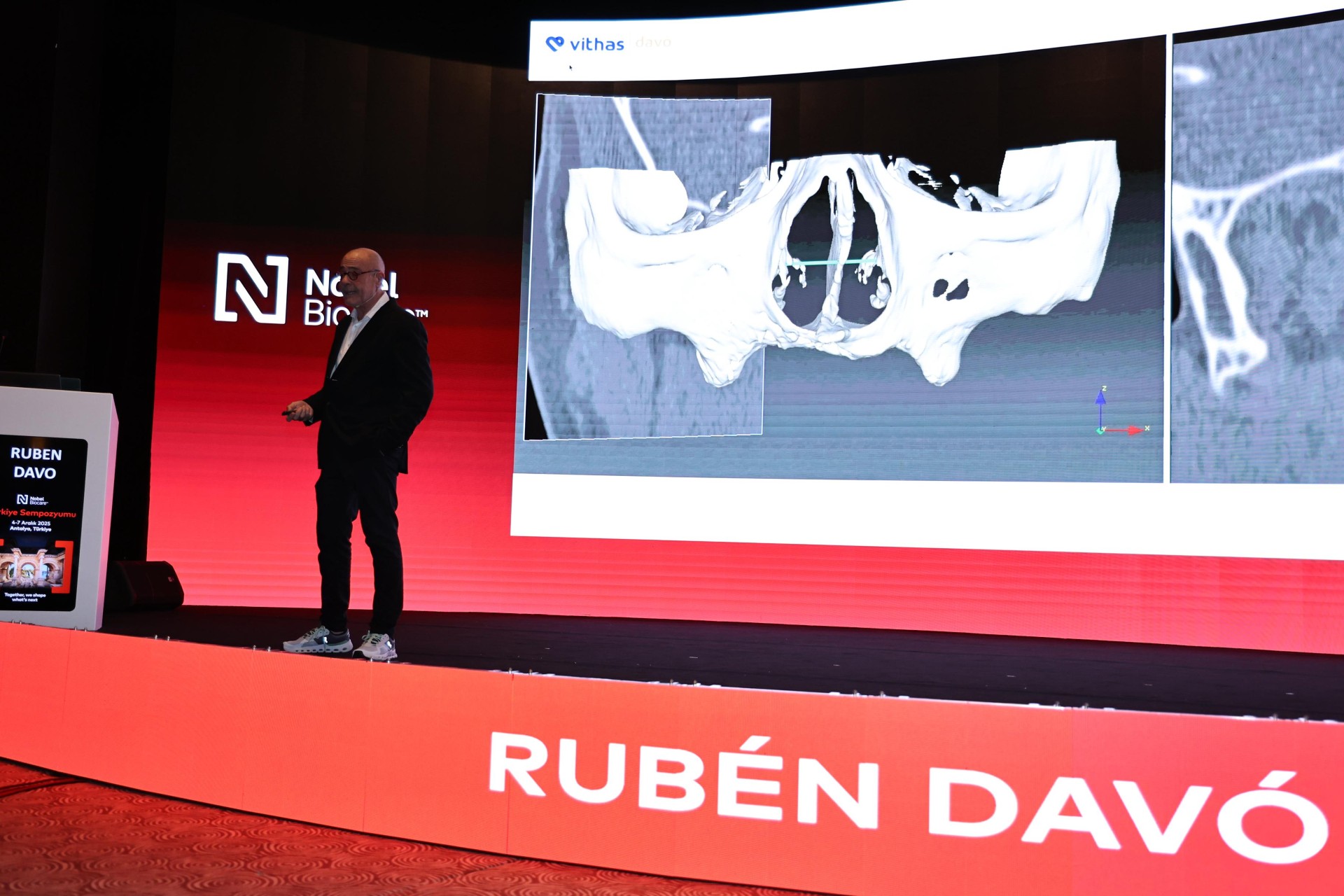 Un estudio internacional coliderado por el Dr. Rubén Davó, de Vithas Medimar, valida el uso de la IA en la planificación de cirugía de implantes cigomáticos