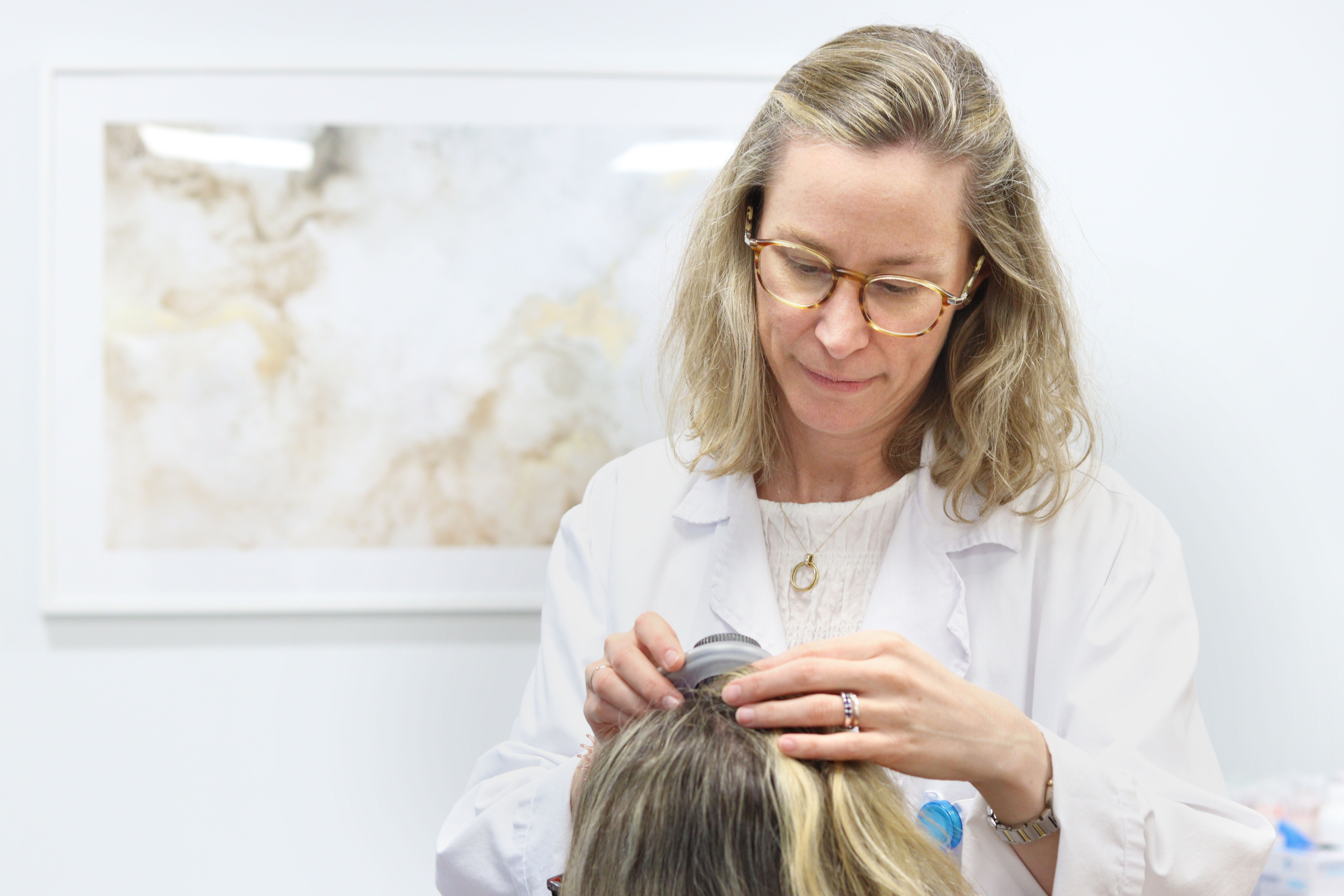 Dermatología de Vithas Madrid La Milagrosada las claves para frenar la alopecia femenina tras la menopausia