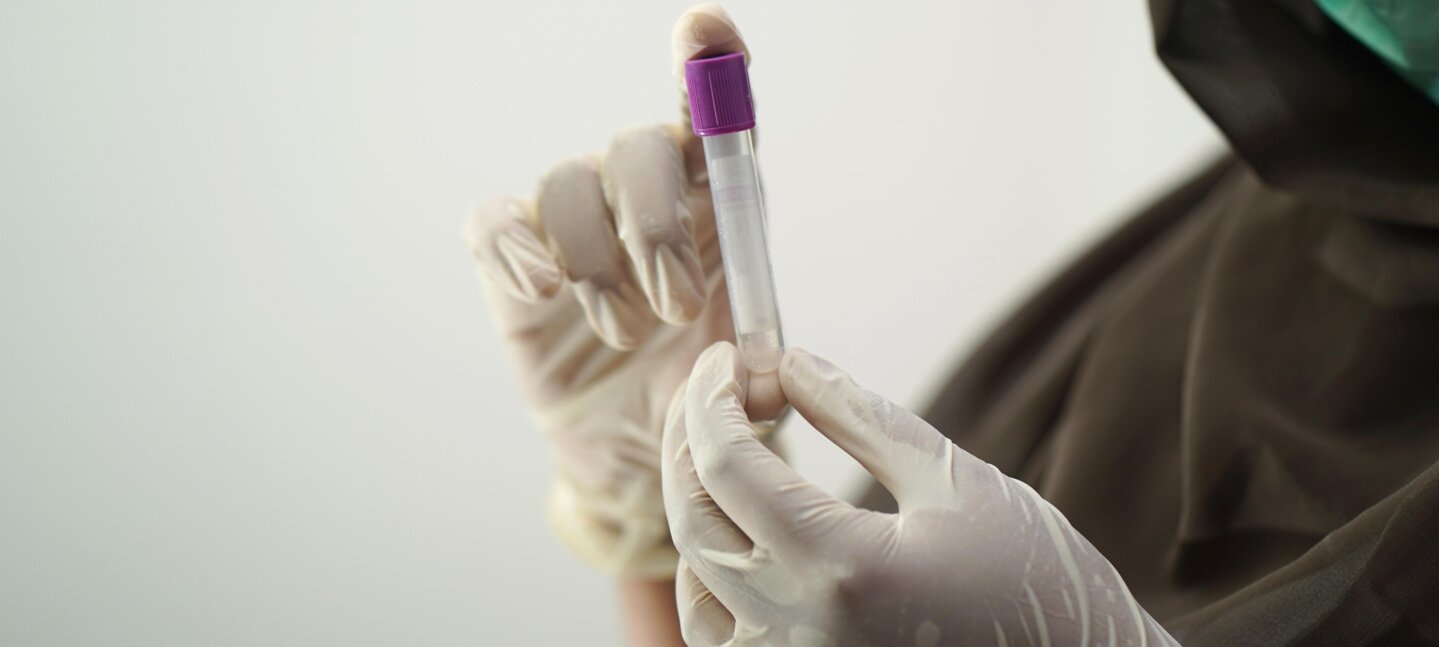 Lipoproteína(a): el factor de riesgo cardiovascular que muchas personas no saben que tienen Lipoproteína(a): el factor de riesgo cardiovascular que muchas personas no saben que tienen