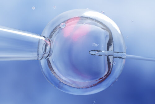 Fecundación in vitro (FIV) con ovodonación
