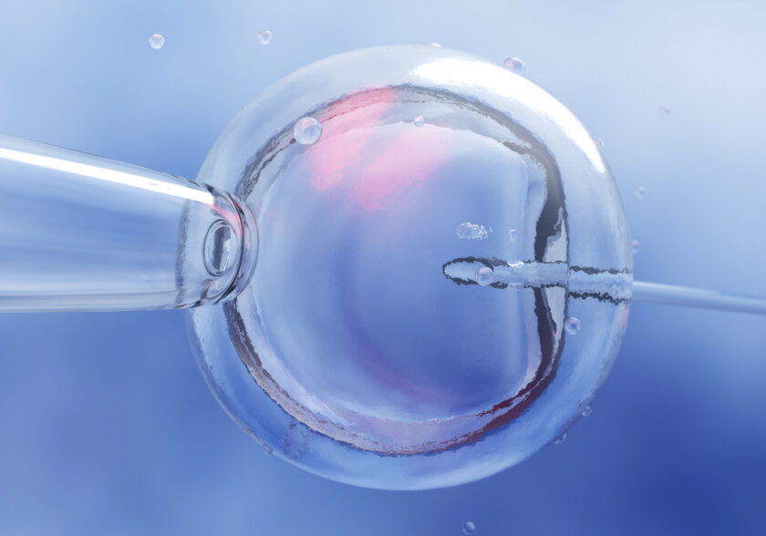 Fecundación in vitro (FIV) con ovodonación Fecundación in vitro (FIV) con ovodonación