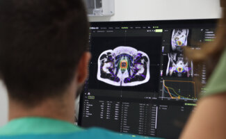 Oncología Radioterápica de Vithas Madrid La Milagrosa muestra la eficacia de la radioterapia adaptativa en el cáncer de próstata