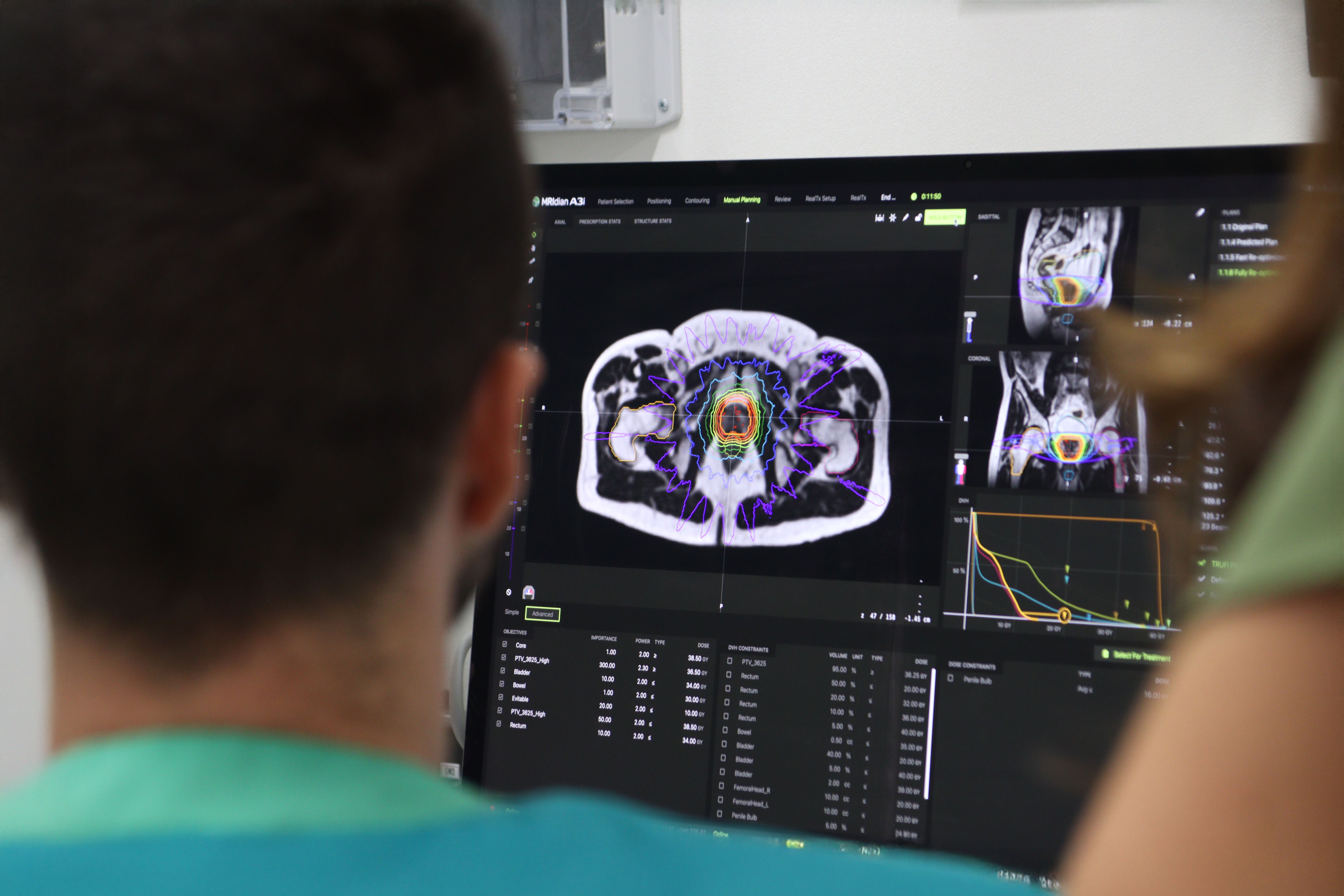 Oncología Radioterápica de Vithas Madrid La Milagrosa muestra la eficacia de la radioterapia adaptativa en el cáncer de próstata