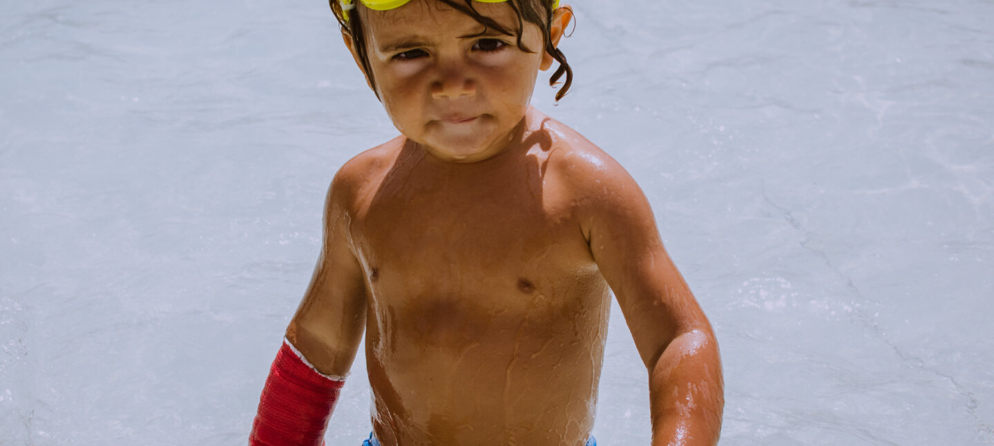 Cuidado con los niños: las lesiones traumatológicas suben en verano Cuidado con los niños: las lesiones traumatológicas suben en verano